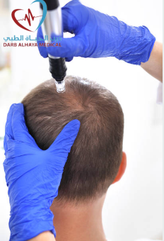 ما هي افضل عيادات زراعة الشعر في السعودية:0531806360