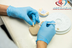 ارخص زراعة اسنان في الرياض: 0531806360