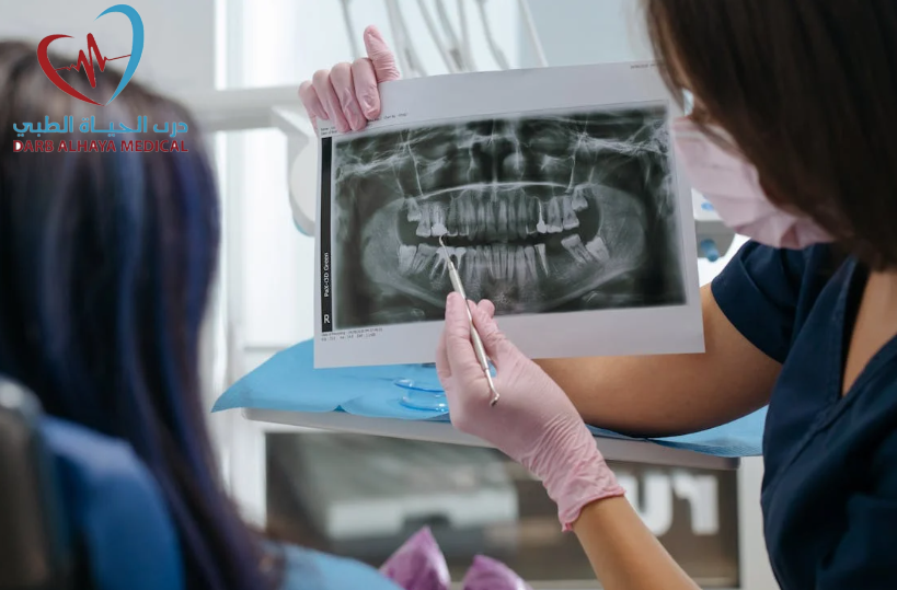 افضل زراعة اسنان: 0531806360